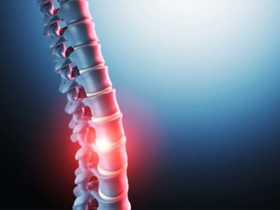 Osteopatia e hérnia de disco